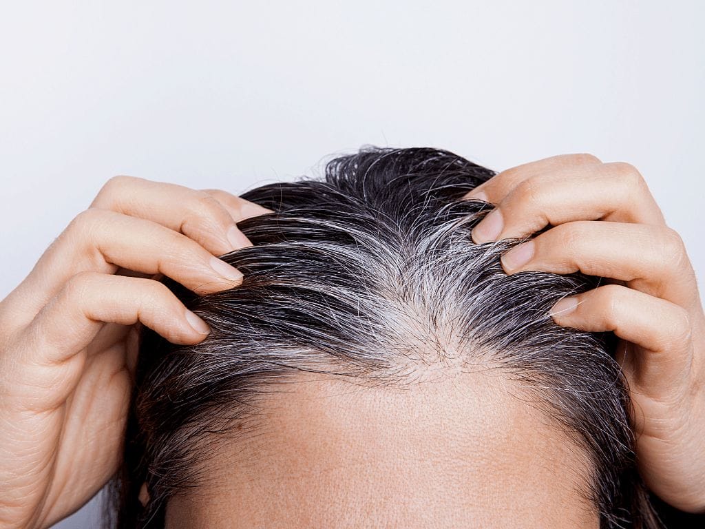 Stress Turns Hair White, Stress Turns Hair White,