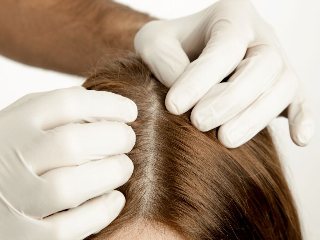 Top 10 Best Hair Loss Treatment Services in Raffles Place and Tanjong  Pagar, Singapore