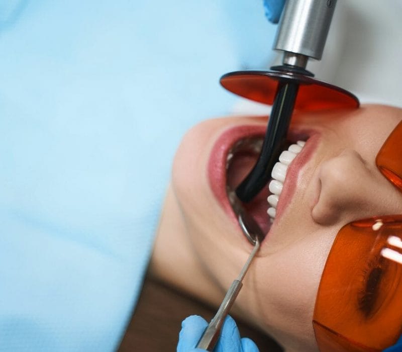 Root Canal Treatments in Singapore