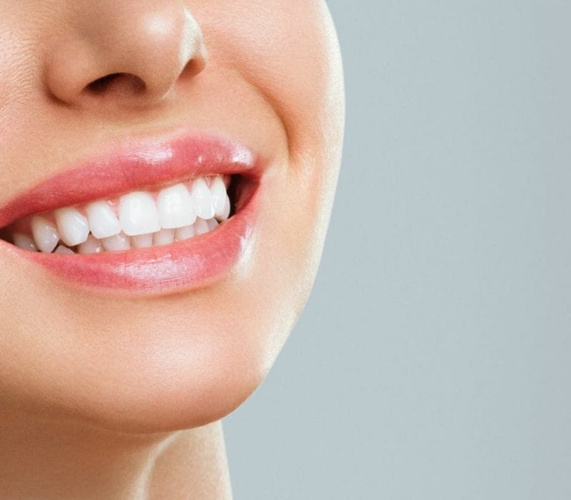 Affordable Teeth Whitening Specialists in Singapore