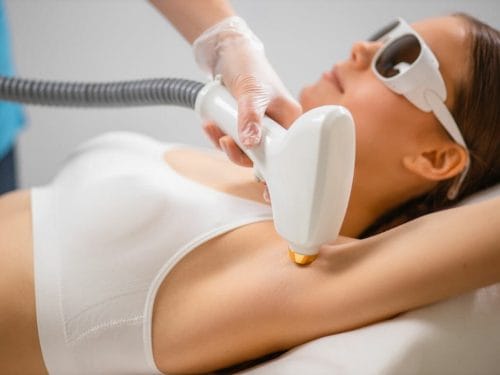 Best SHR Hair Removal Specialists in Singapore