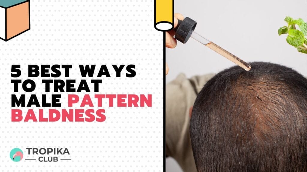 Best Ways to Treat Male Pattern Baldness