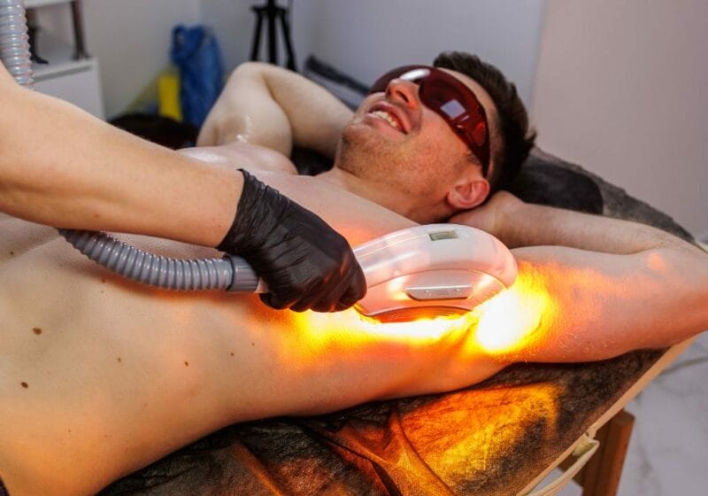 The Best Guide for Men Laser Hair Removal Treatment in Singapore