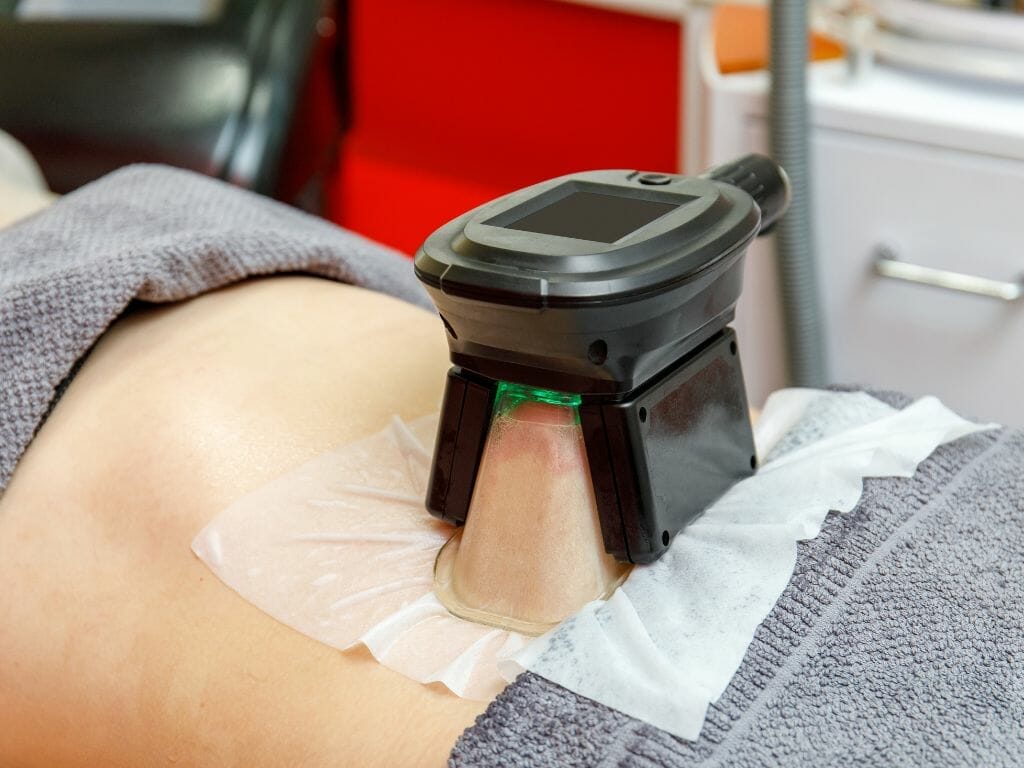 Fat Freezing Services in Johor