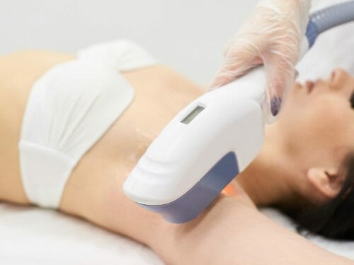 Most Affordable Hair Removal Providers in Singapore