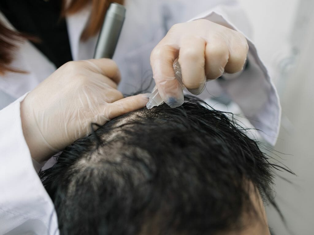 Singapore's More Affordable Hair Regrowth Centres
