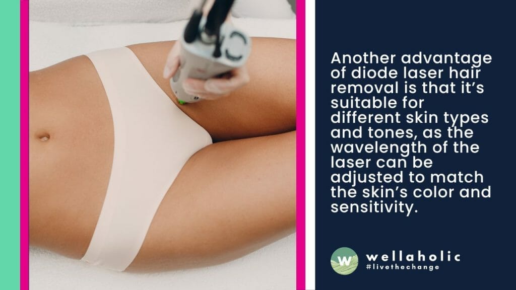 Another advantage of diode laser hair removal is that it’s suitable for different skin types and tones, as the wavelength of the laser can be adjusted to match the skin’s color and sensitivity. 