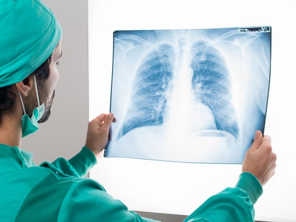 Facts about Lung Cancer All Singaporeans Should Know