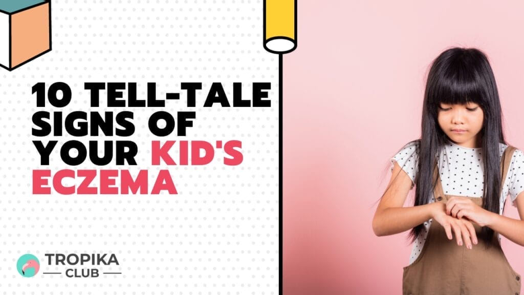 10 Tell-Tale Signs of Your Kid's Eczema
