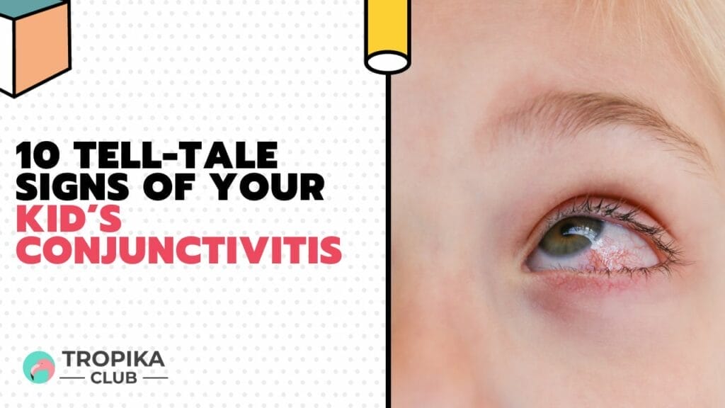 10 Tell-Tale Signs of Your Kid’s Conjunctivitis