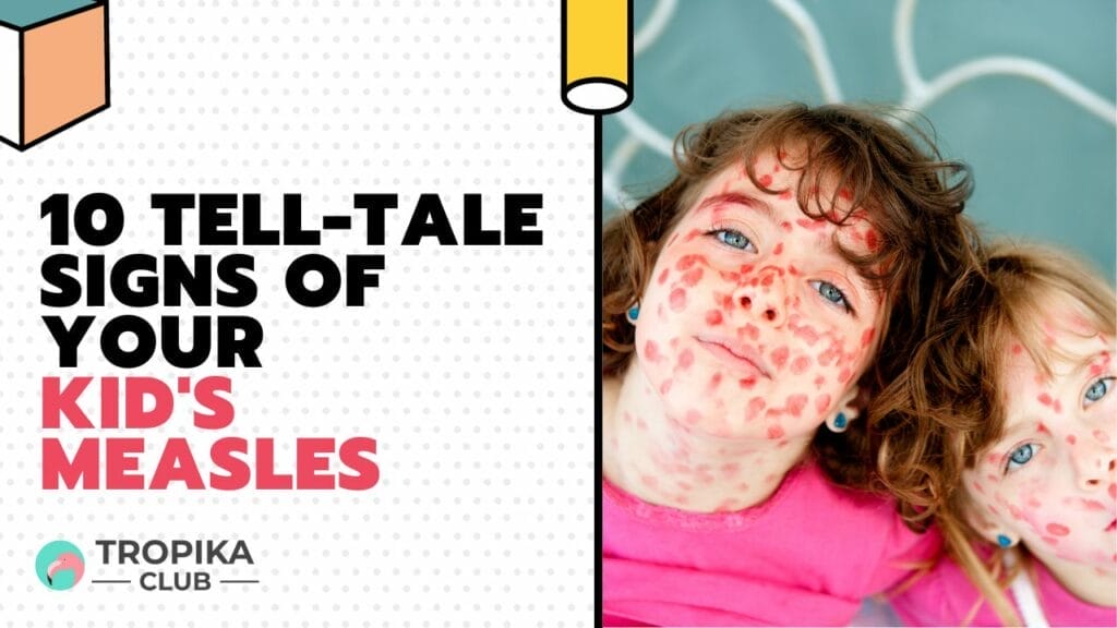10 Tell-Tale Signs of Your Kid's Measles
