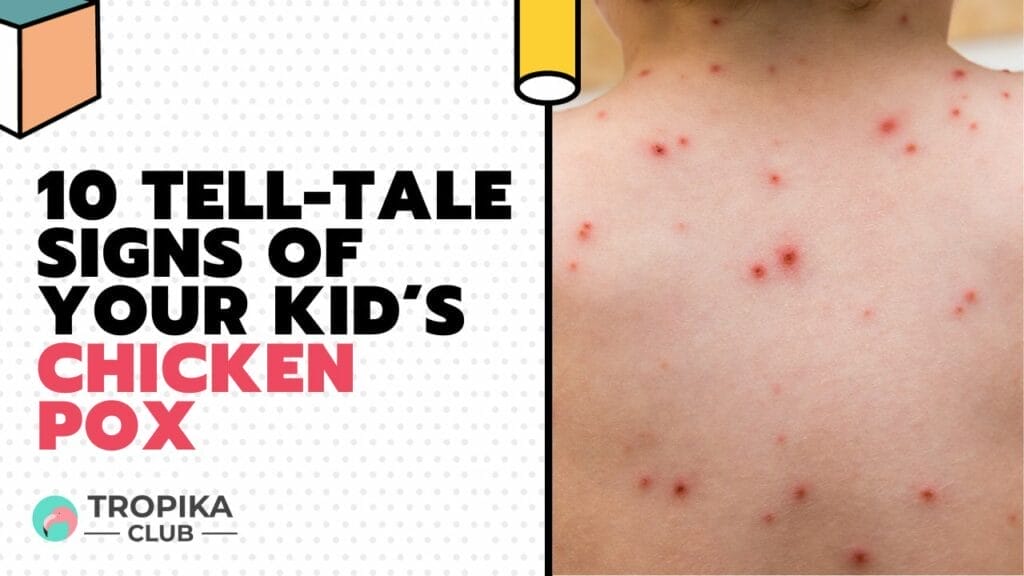 Tell-Tale Signs of Your Kid’s Chicken Pox