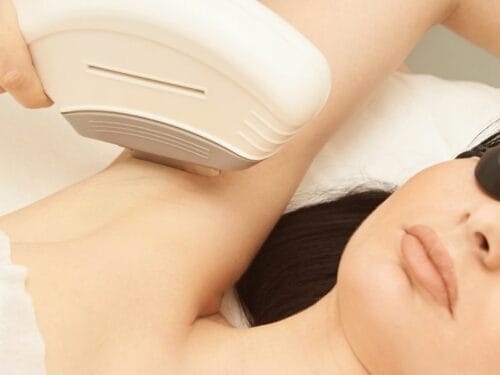 10 Places for Underarm Hair Removal in Singapore