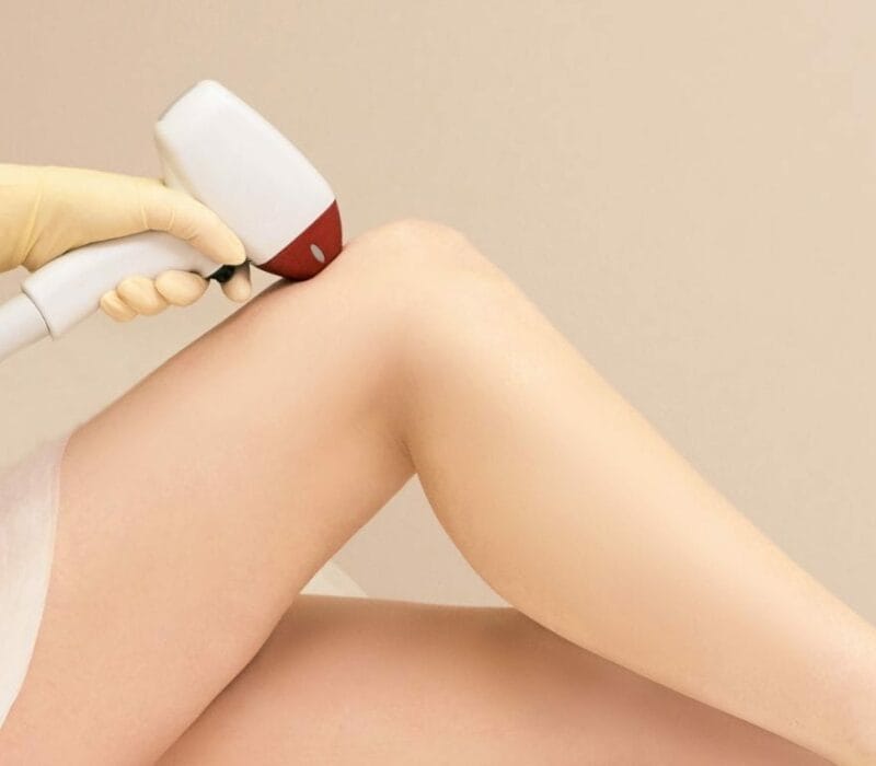 10 Things You Should Know About Permanent Hair Removal in Singapore
