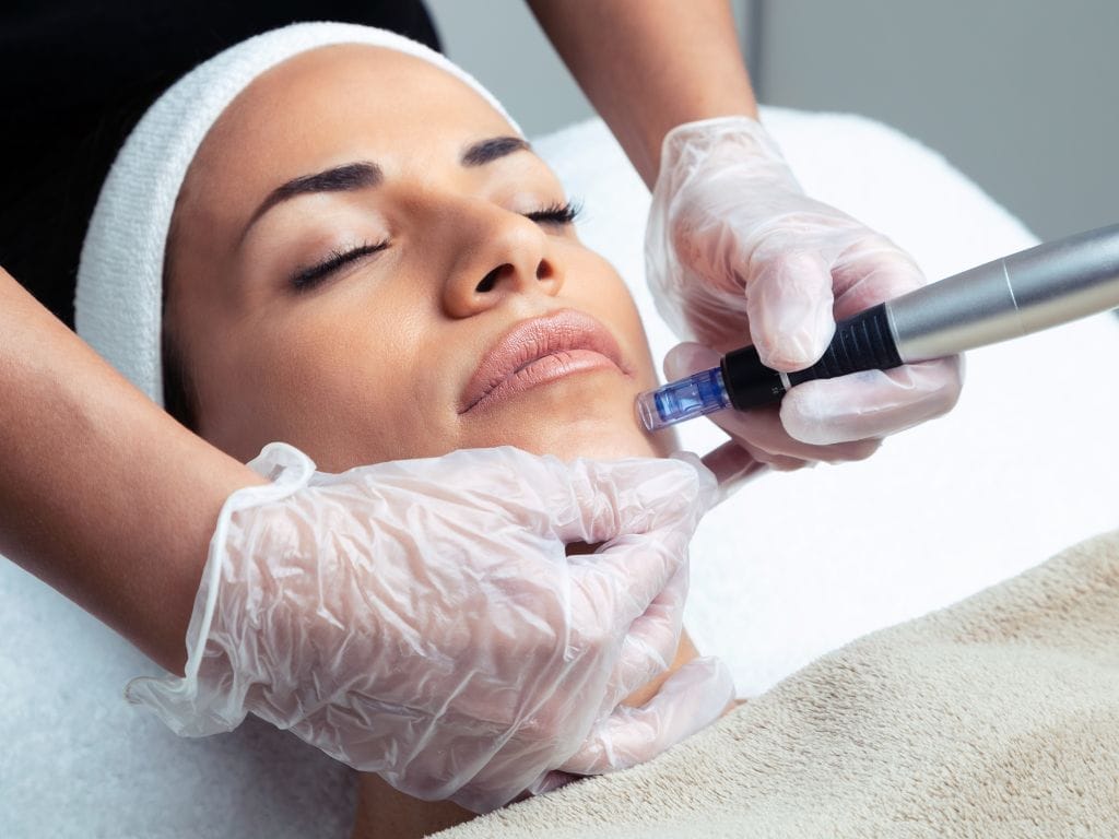 10 Things to Know Before Your First Microneedling Session in Singapore