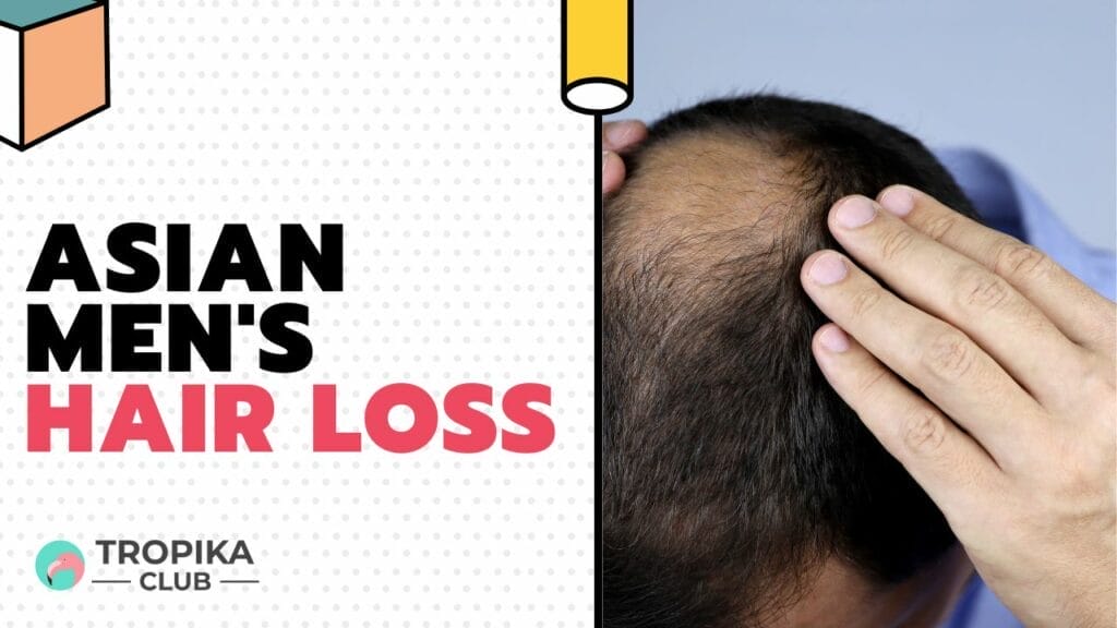 Asian Men's Hair Loss