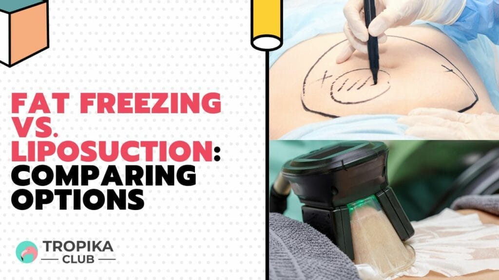 Fat Freezing vs. Liposuction Comparing Options