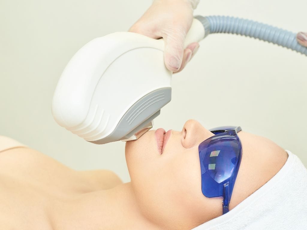 Affordable IPL and RF Monthly Facials