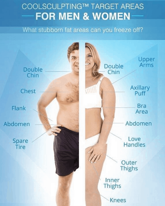 Target Areas for Fat Freezing: From Double Chin to Thighs