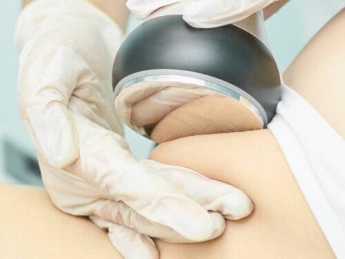 Slim on a Budget Affordable Fat Cavitation Secrets in Singapore