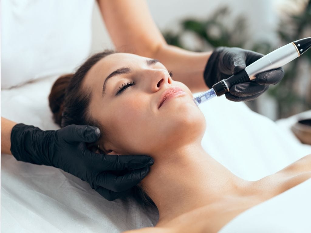 Shiok Microneedling Facials in Raffles Place That Won't Break the Bank