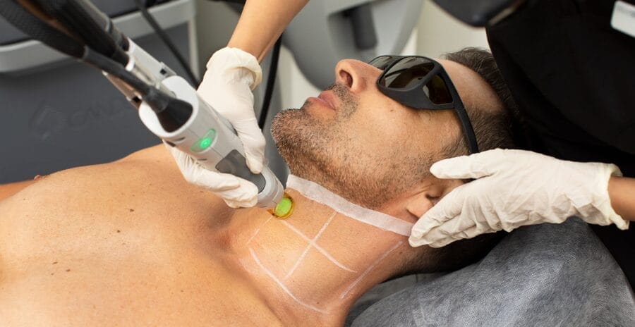 Tailored Hair Removal Treatments for Men