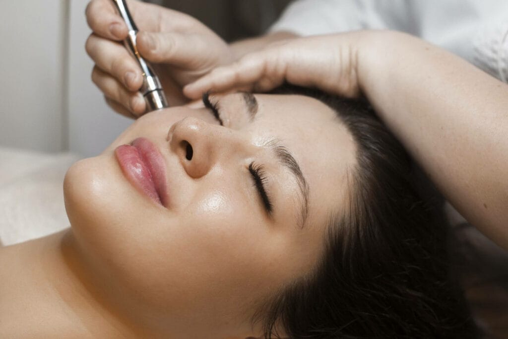 Microneedling for Acne Treatment