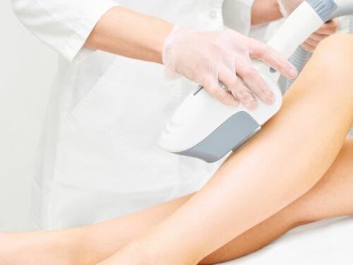 How to Maintain Results After Laser Hair Removal in Singapore