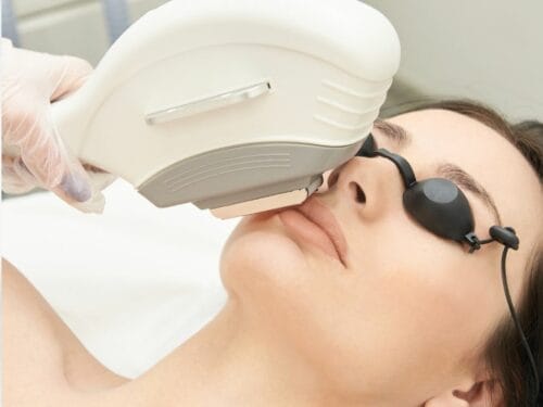 Laser Hair Removal for Hormonal Hair Growth in Singapore