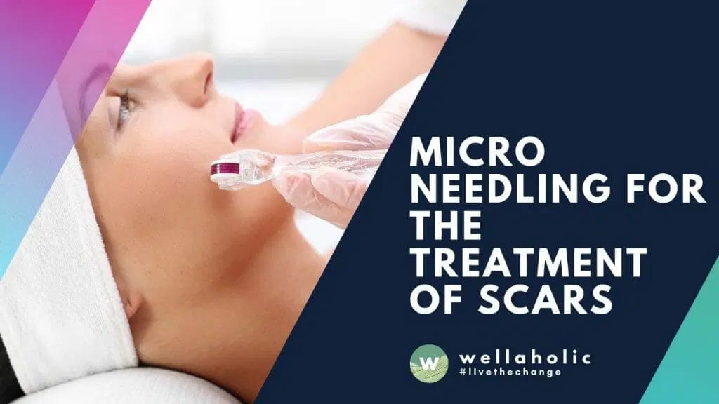 Top Microneedling Providers Singapore