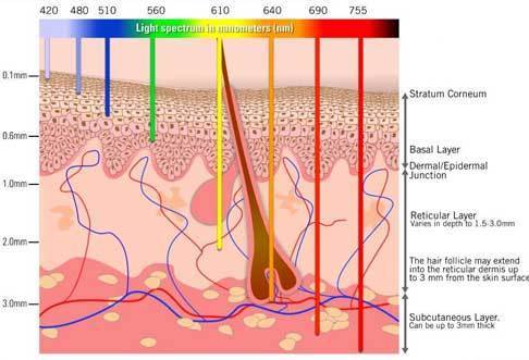 SHR Diode Laser Technology