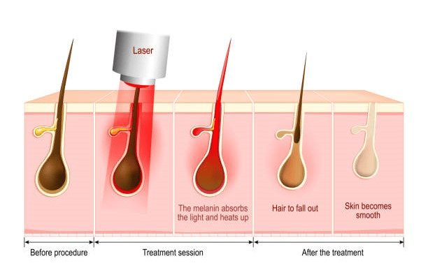 Optimizing Treatment Effectiveness