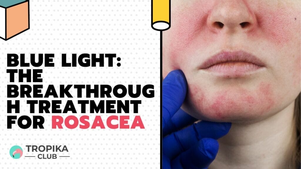 Blue Light: The Breakthrough Treatment for Rosacea