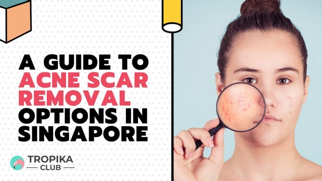 A Guide to Acne Scar Removal Options in Singapore