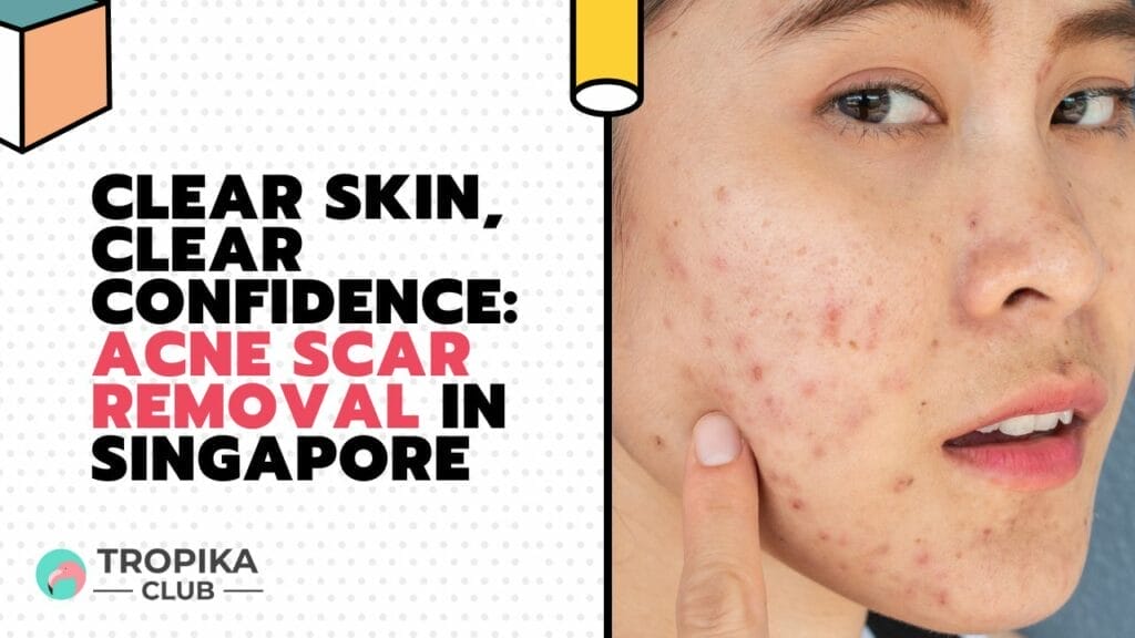 Clear Skin, Clear Confidence Acne Scar Removal in Singapore