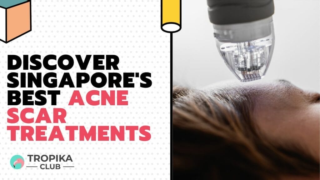 Discover Singapore's Best Acne Scar Treatments