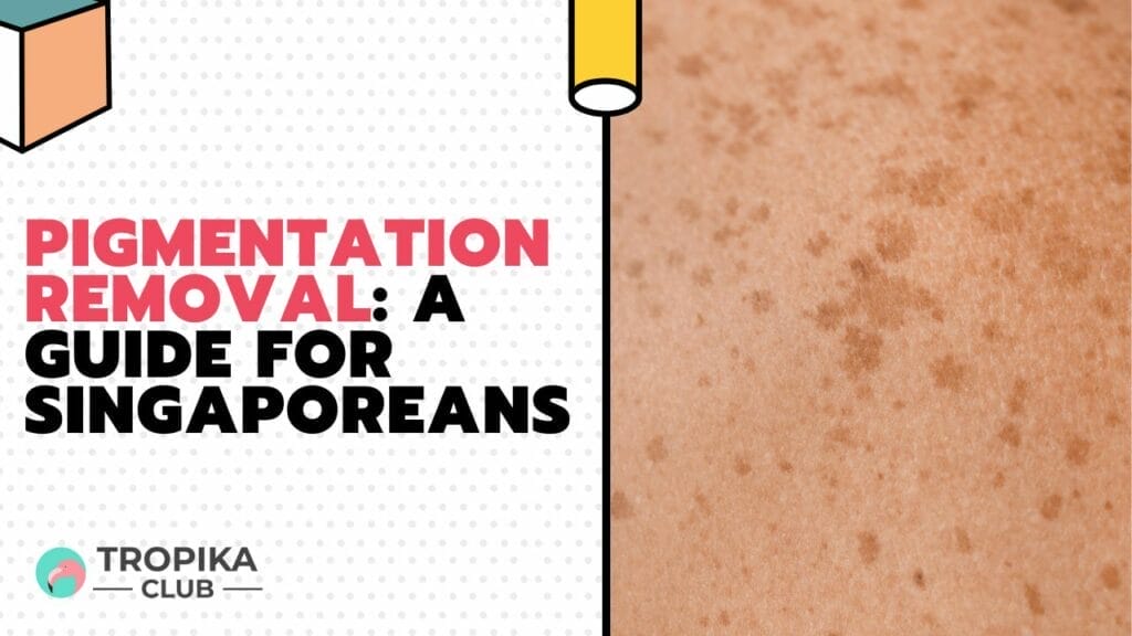 Pigmentation Removal A Guide for Singaporeans