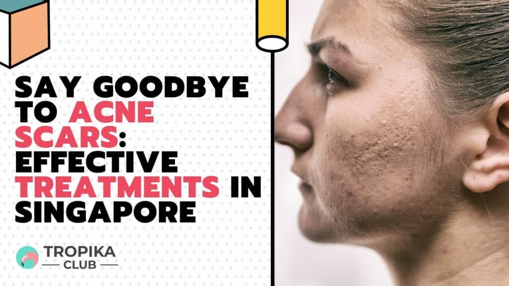 Say Goodbye to Acne Scars Effective Treatments in Singapore