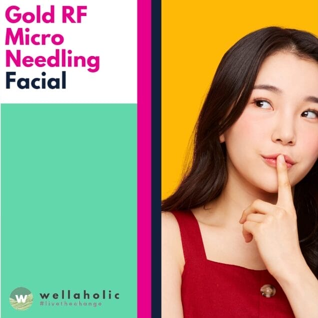 RF Microneedling for Pigmentation